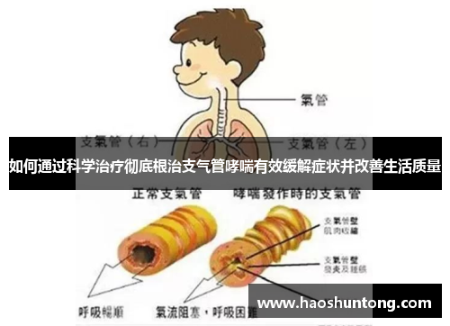 如何通过科学治疗彻底根治支气管哮喘有效缓解症状并改善生活质量